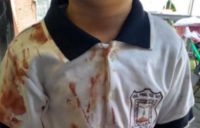 Mamá denuncia bullying a su hijo en redes sociales