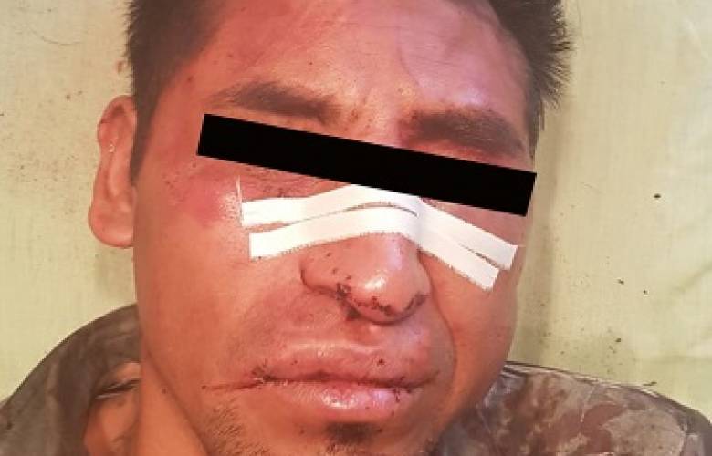 Asegura Policía de Toluca a sujeto por presunto robo a transporte público en San Andrés Cuexcontitlán