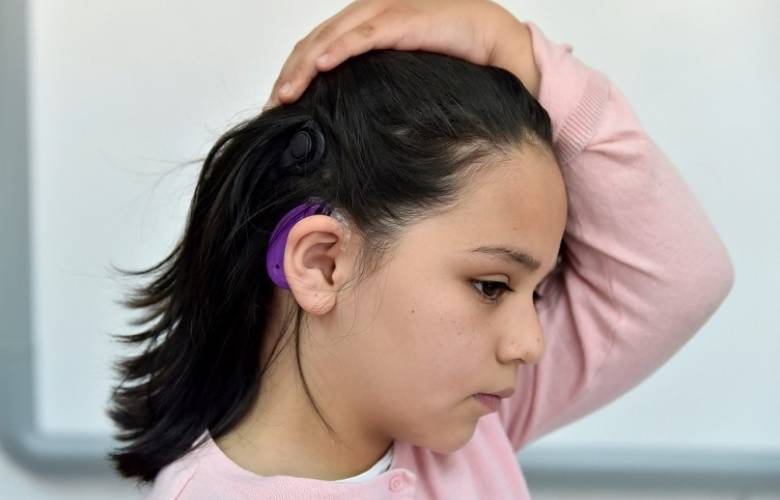 Entrega DIFEM más de mil 600 aparatos auditivos al año para personas con sordera