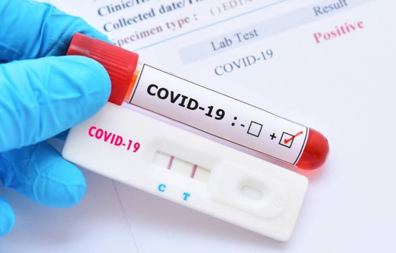 Se dejará de aplicar pruebas gratuitas de COVID-19 en farmacias y centros comerciales en CDMX