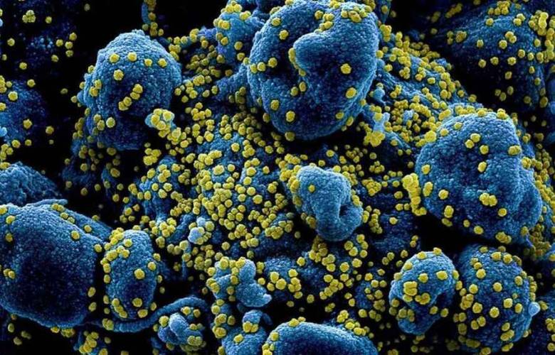 OMS alerta por virus más peligroso que el Covid