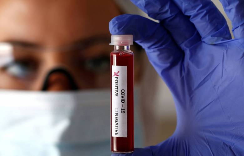 Un análisis de sangre permite seguir la evolución de la infección por COVID-19 en el organismo